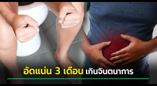 ท้องผูก