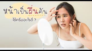 ผื่นคัน