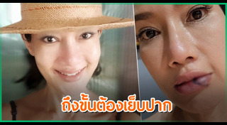 ดี้ ชนานา