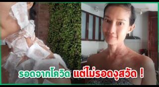 ดี้ ชนานา