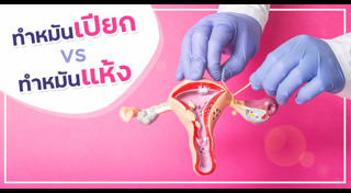 ทำหมันหญิง