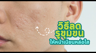 รูขุมขนกว้าง