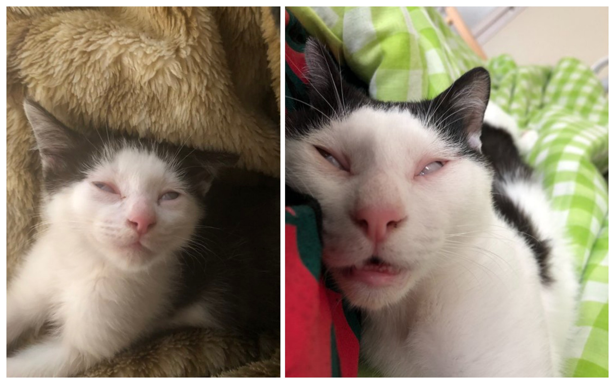 before after