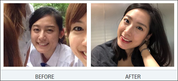 ลดน้ำหนัก