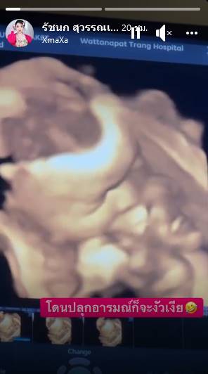 เจนนี่ ยิว  เผยภาพอัลตราซาวด์ลูกสาว