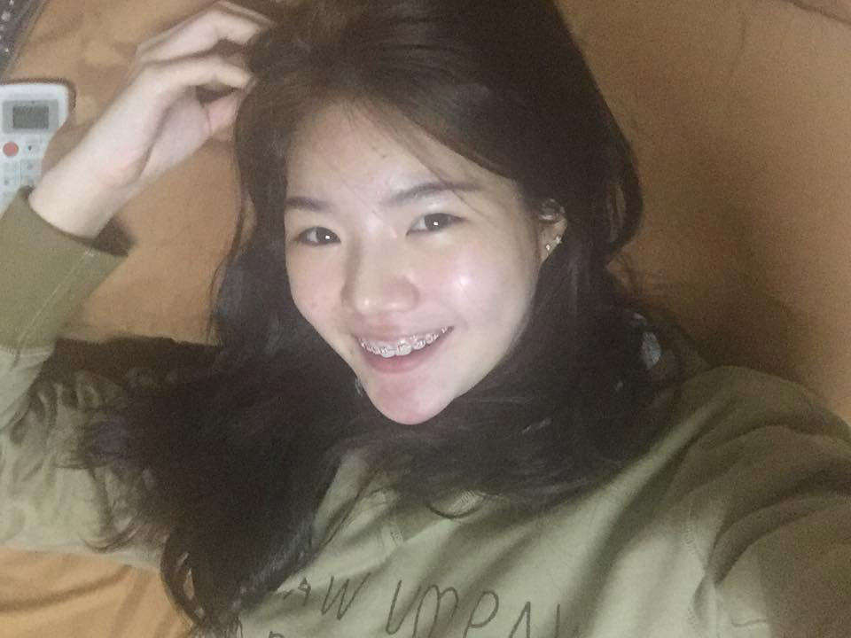 อิงอิง อิงณภัสร์, ศัลยกรรม