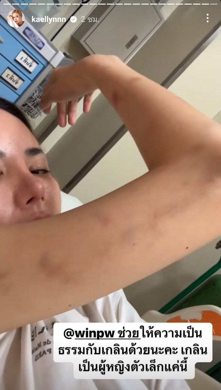 แฟนเก่าทำร้ายร่างกาย