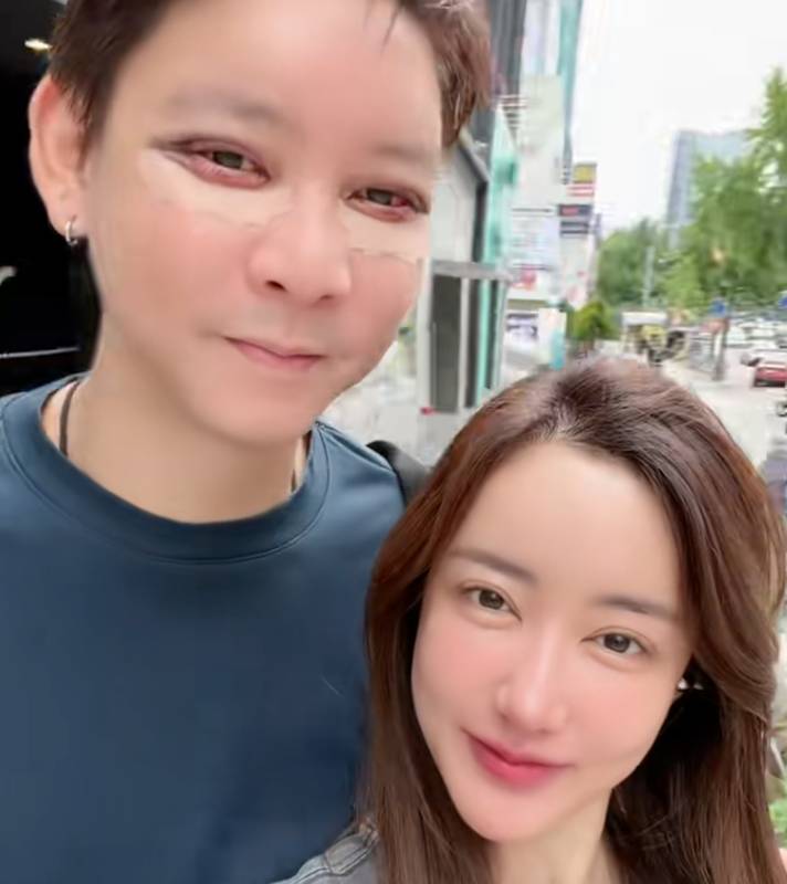 จิน จรินทร์ ศัลยกรรม