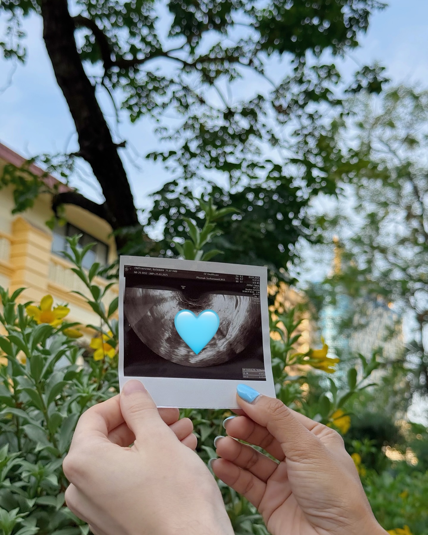 มิน รตวรรณ ฝากไข่