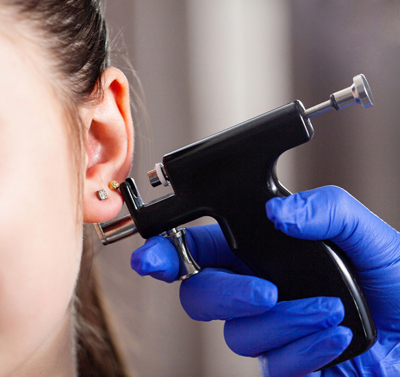 แผลเจาะหู