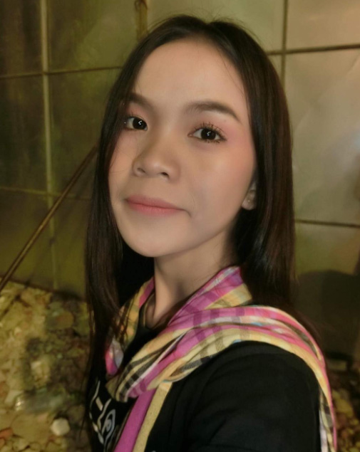 อาม ชุติมา ศัลยกรรมอะไรมาบ้าง เปิดภาพหน้าเก่า VS หน้าใหม่