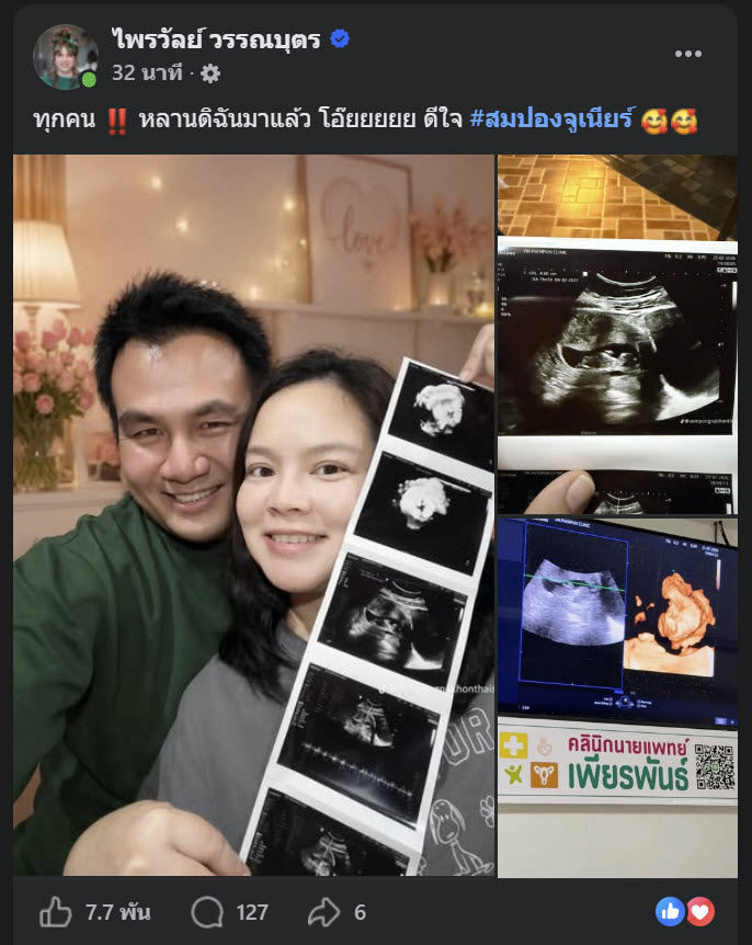 แพรรี่ ไพรวัลย์