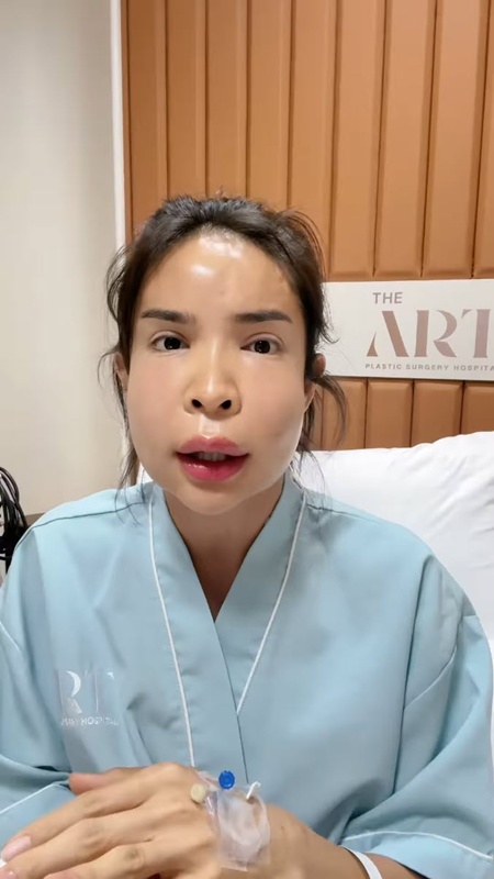 นัท นิสามณี หน้าบวมจนจำไม่ได้