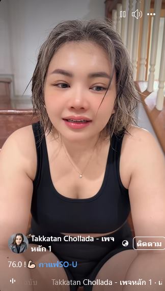 ตั๊กแตน ชลดา ศัลยกรรมหน้า