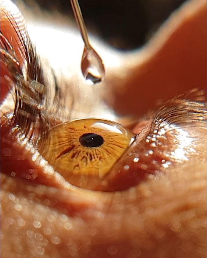 ภาพถ่ายดวงตามนุษย์