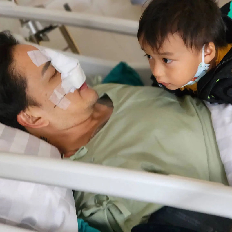 แทค ภรัณยู จมูกหัก