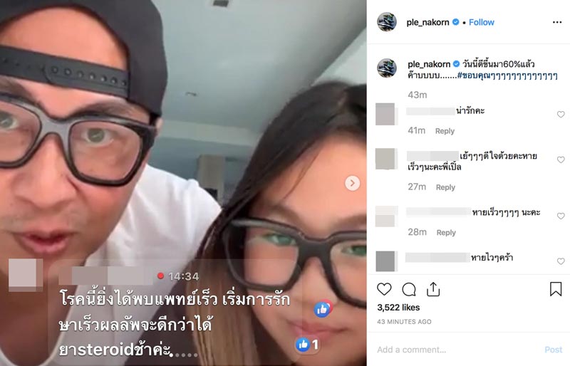 เปิ้ล นาคร