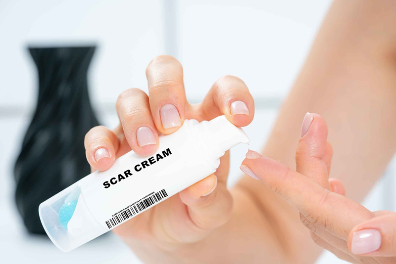 ครีมทาแผลเป็น ลดรอยดำ