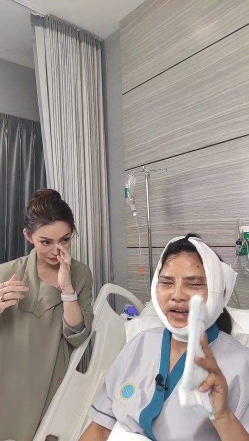 สุนารี ศัลยกรรมหน้า