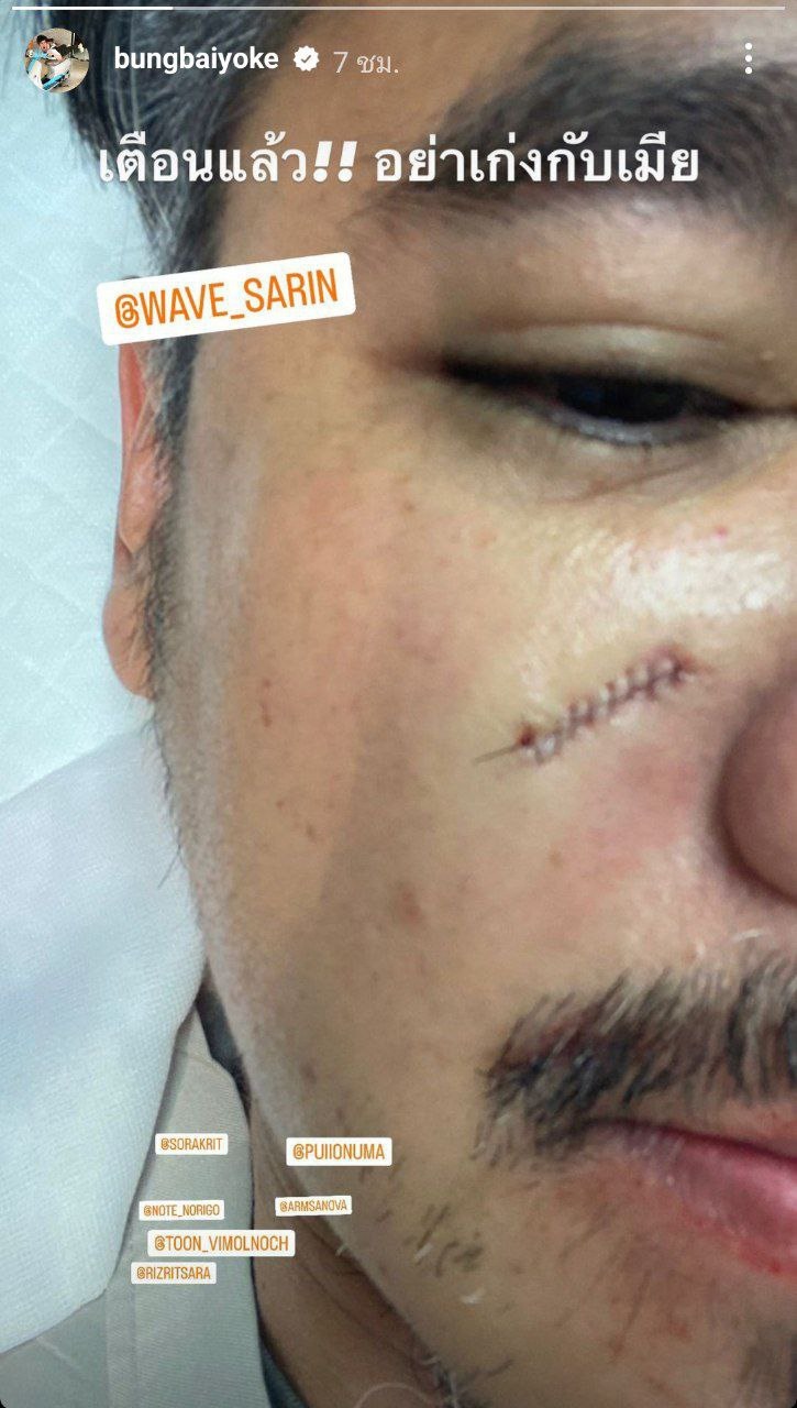 เวฟ วิภพ, บุ้ง สะธี