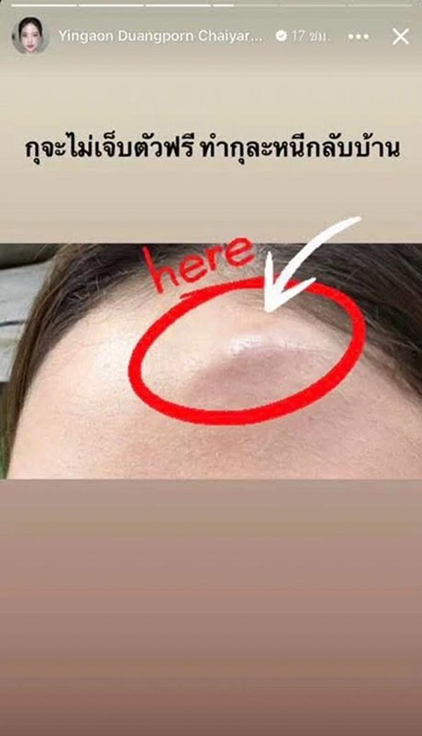 หญิงออน ดวงพร ถูกทำร้าย