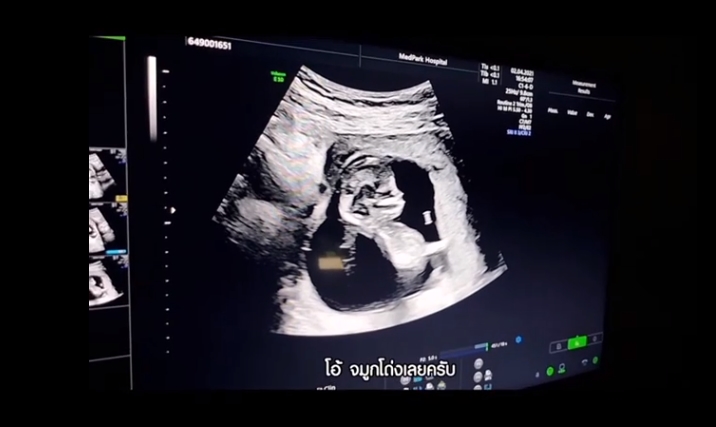  ตูน บอดี้สแลม ก้อย รัชวิน