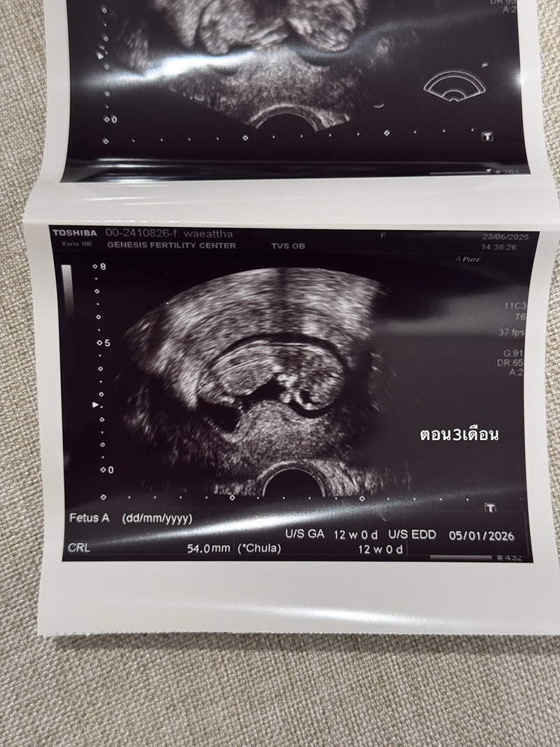 เนย วรัฐฐา ประกาศข่าวดีตั้งท้องลูกคนแรก 