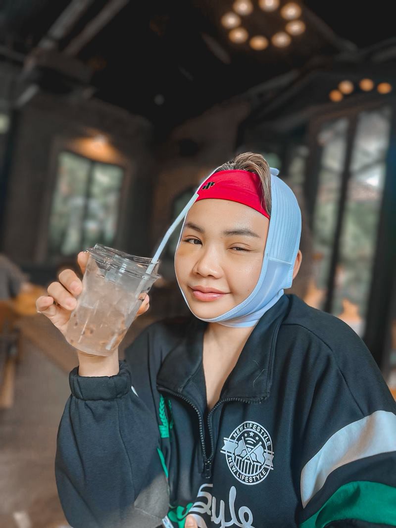 ตั๊กแตน ชลดา ศัลยกรรมหน้า