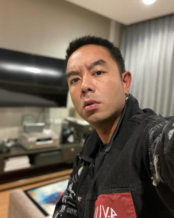 กวาง AB Normal