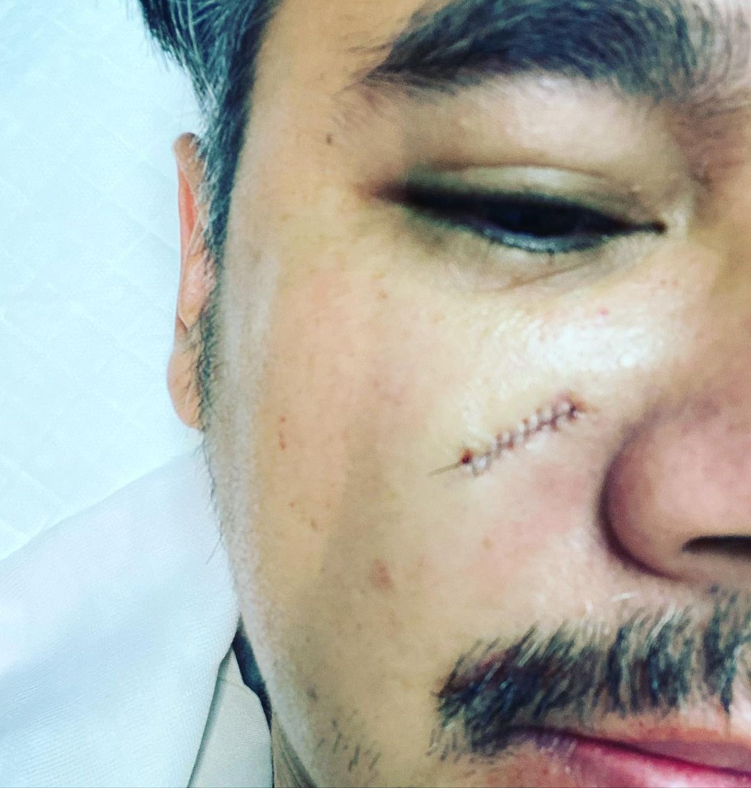 เวฟ วิภพ, บุ้ง สะธี