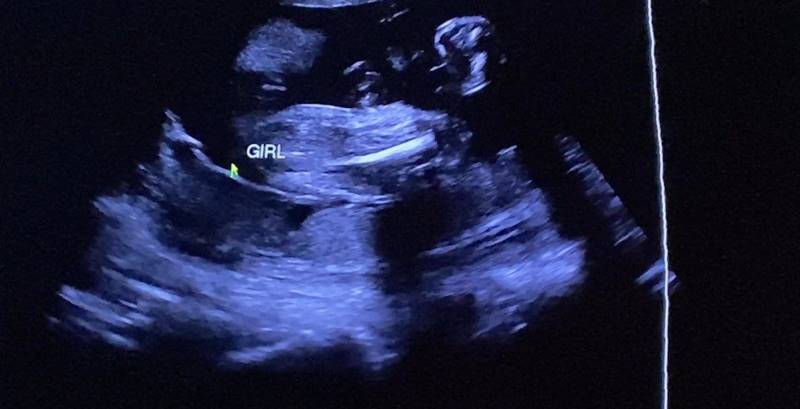 ฟ้า ยงวรี ท้อง