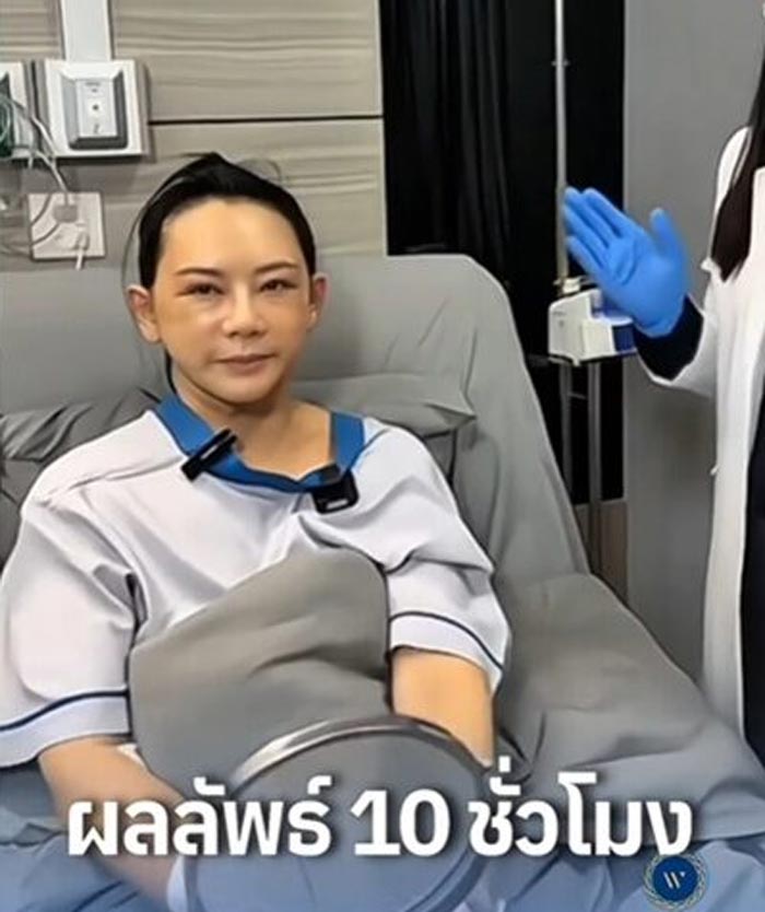 แหม่ม จินตหรา ศัลยกรรม