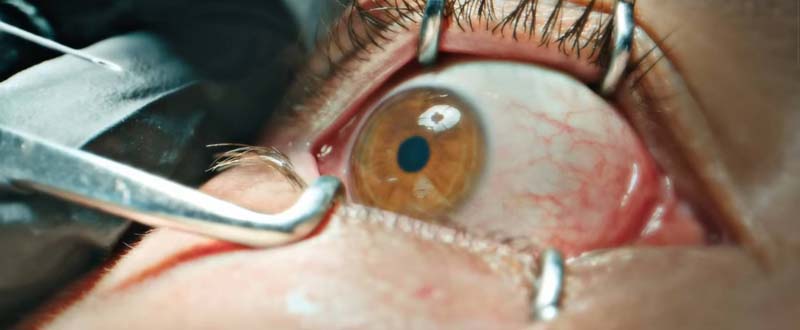 Pete Davidson รับบท แม็กซ์ ในหนัง The Home บ้านพักคนเฮี้ยน