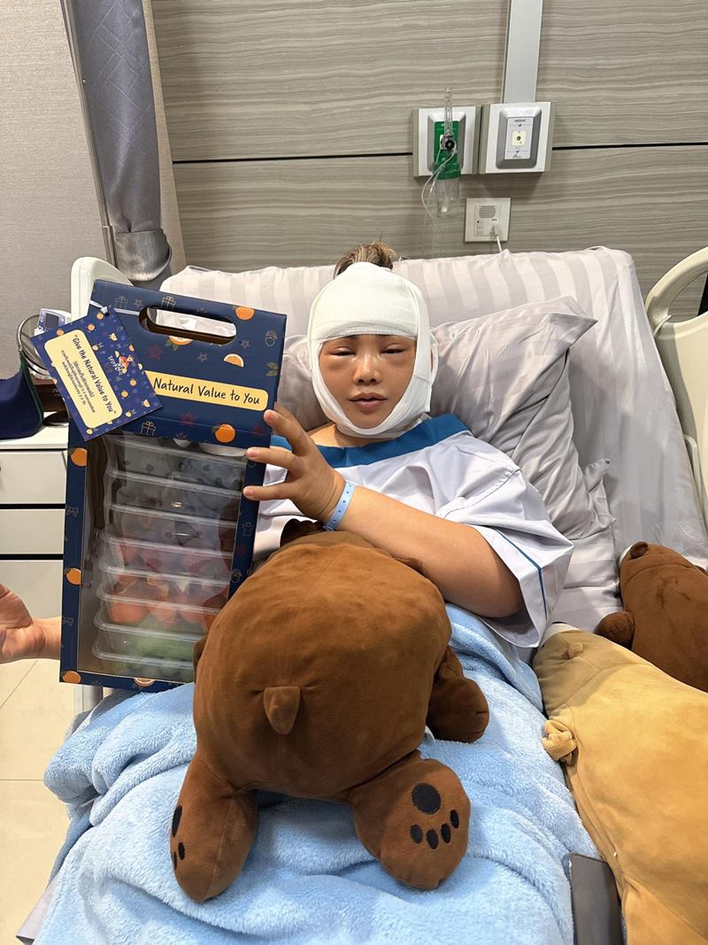 ตั๊กแตน ชลดา ศัลยกรรมหน้า