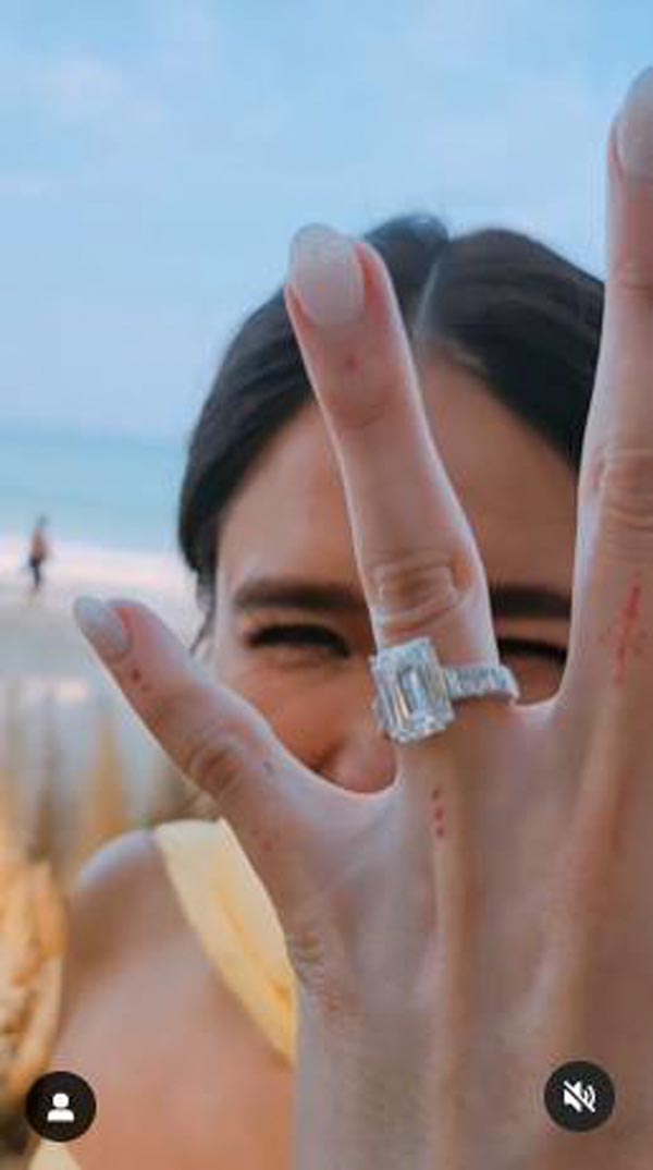 จิ๊บ ปกฉัตร