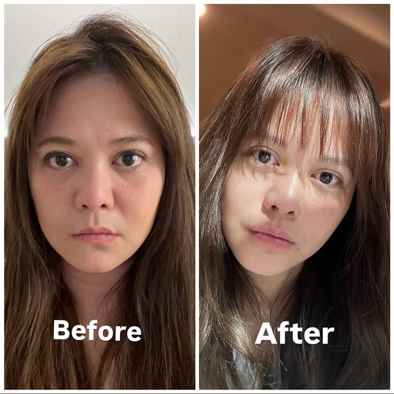 เทียบรูป พิมพ์ พิมพ์มาดา รีวิวทำศัลยกรรมยกหน้าใหม่