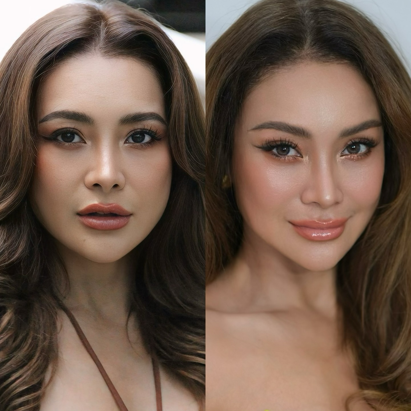 โย ยศวดี ศัลยกรรม