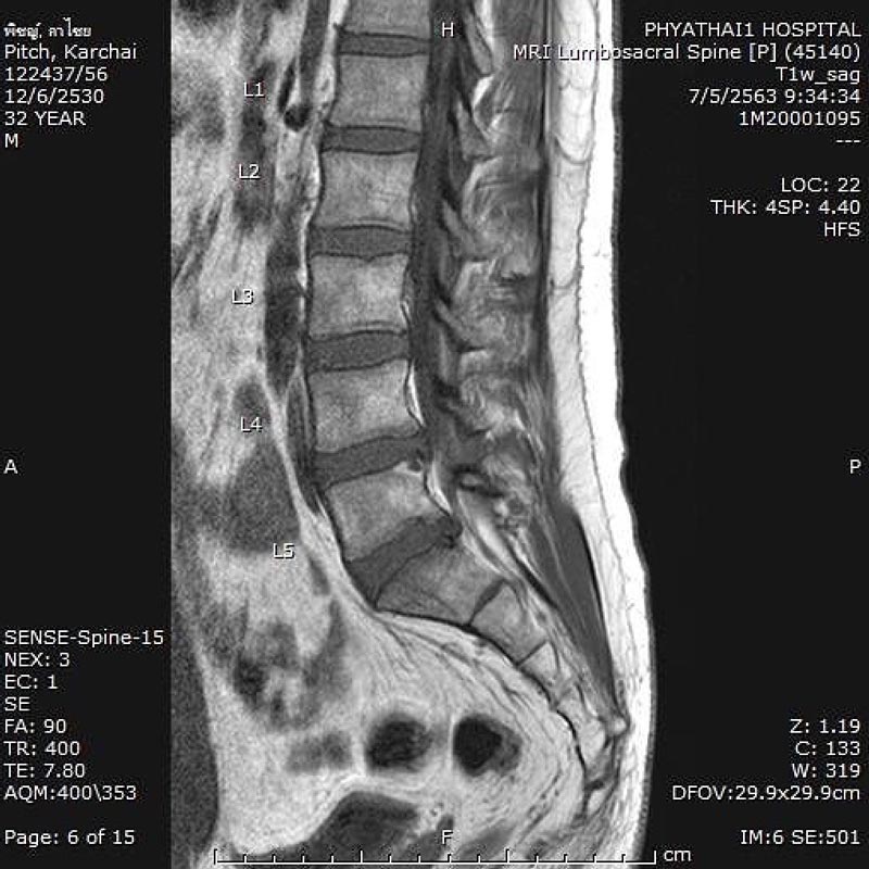 พิชญ์ กาไชย