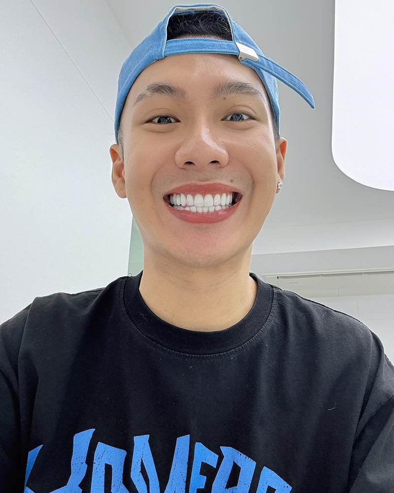 ตั้ม วราวุธ ขี่มอเตอร์ไซค์ชน เจ็บหนัก