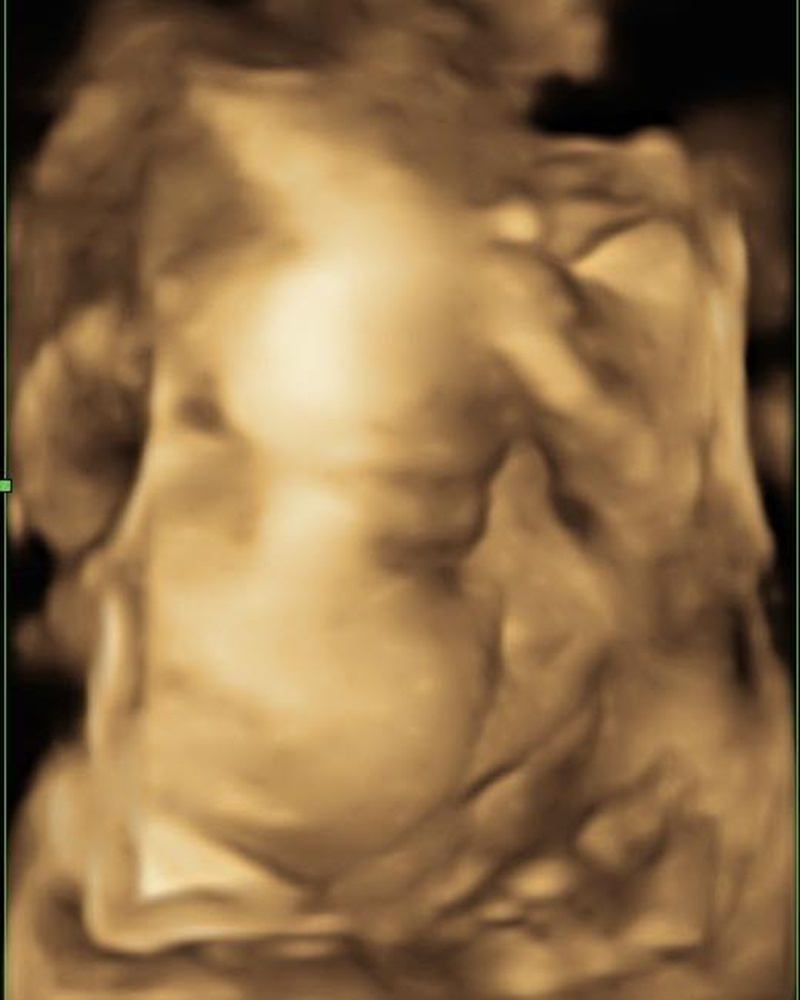 แจ๊ค ธนพล คุณพ่อป้ายแดง 