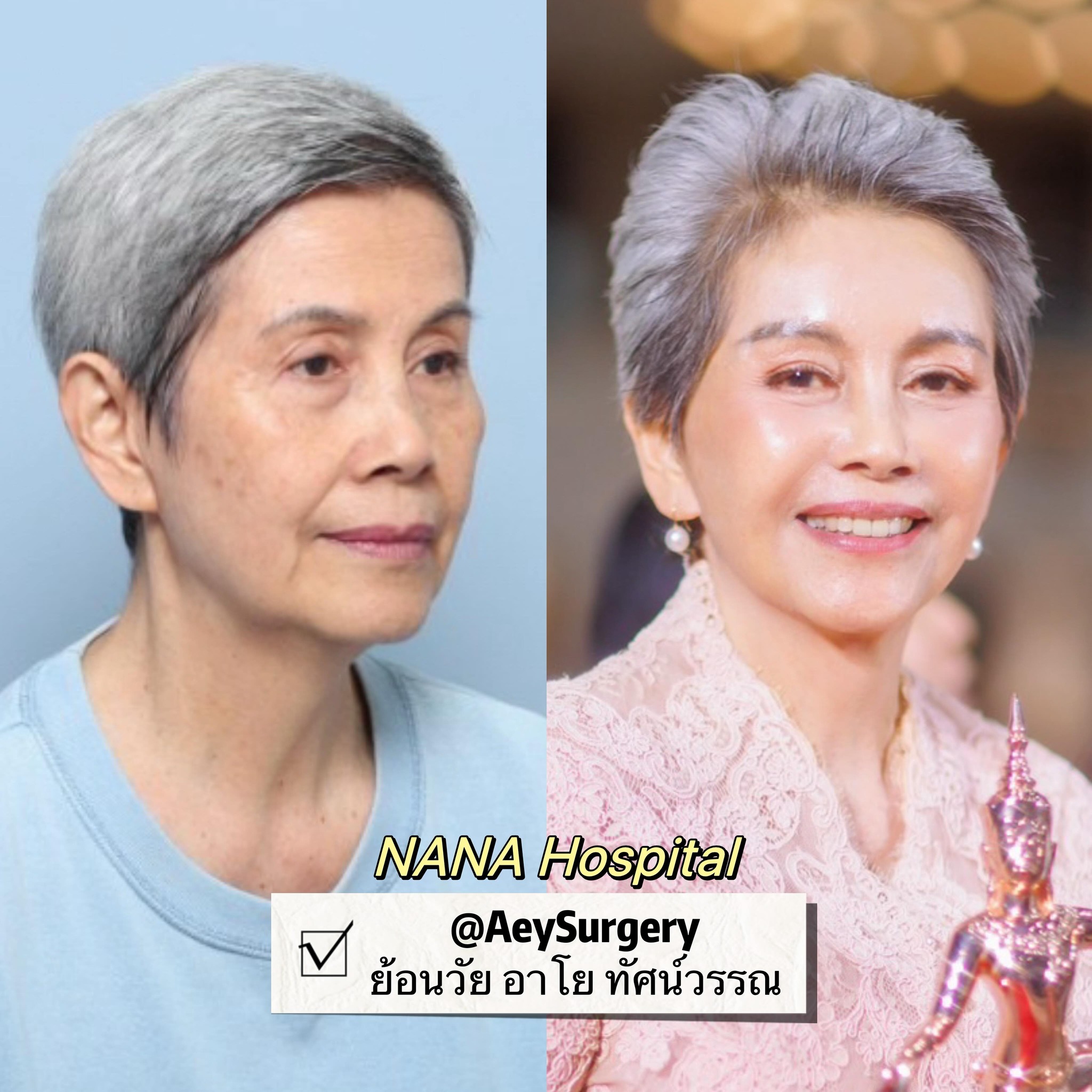 โย ทัศน์วรรณ