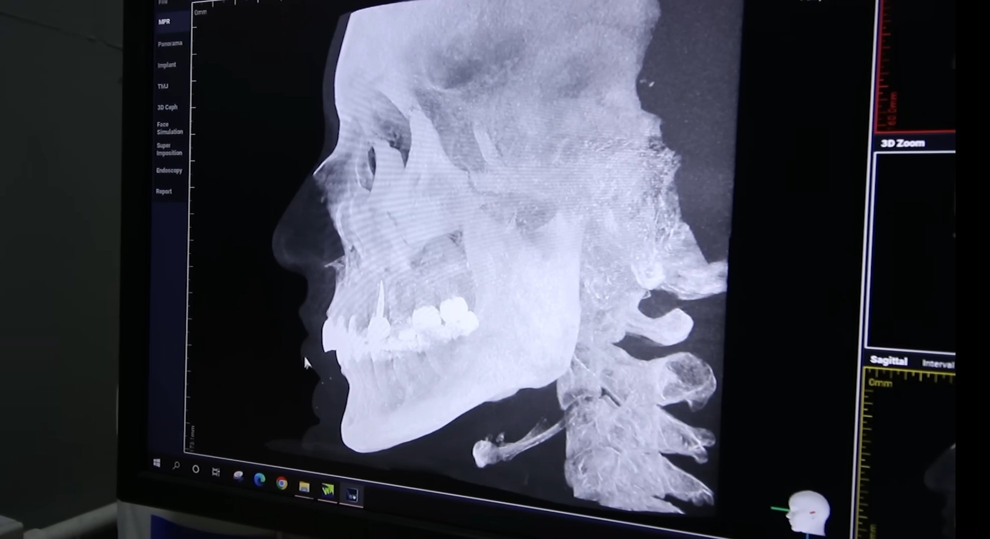 ใหม่ ดาวิกา