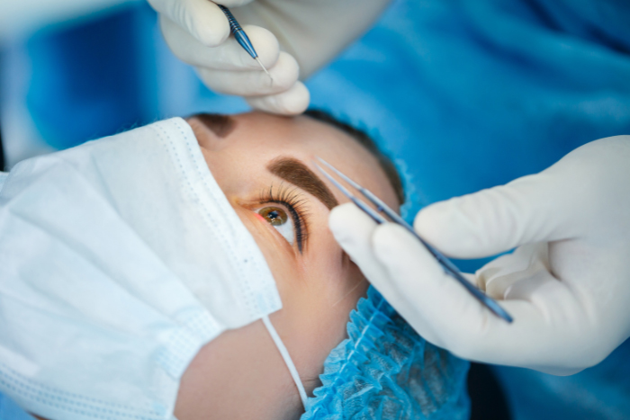 Subbrow Lift แผลซ่อนใต้คิ้ว