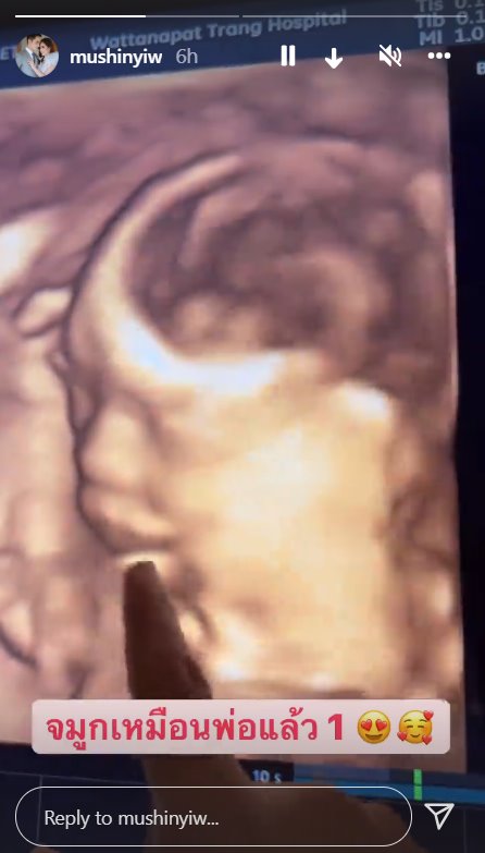 น้องยูจิน