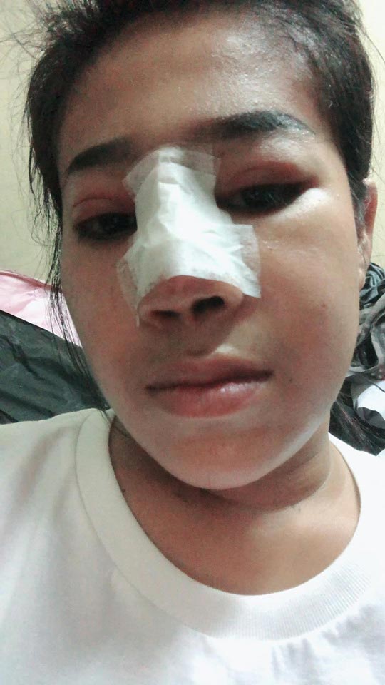 หนูรัตน์