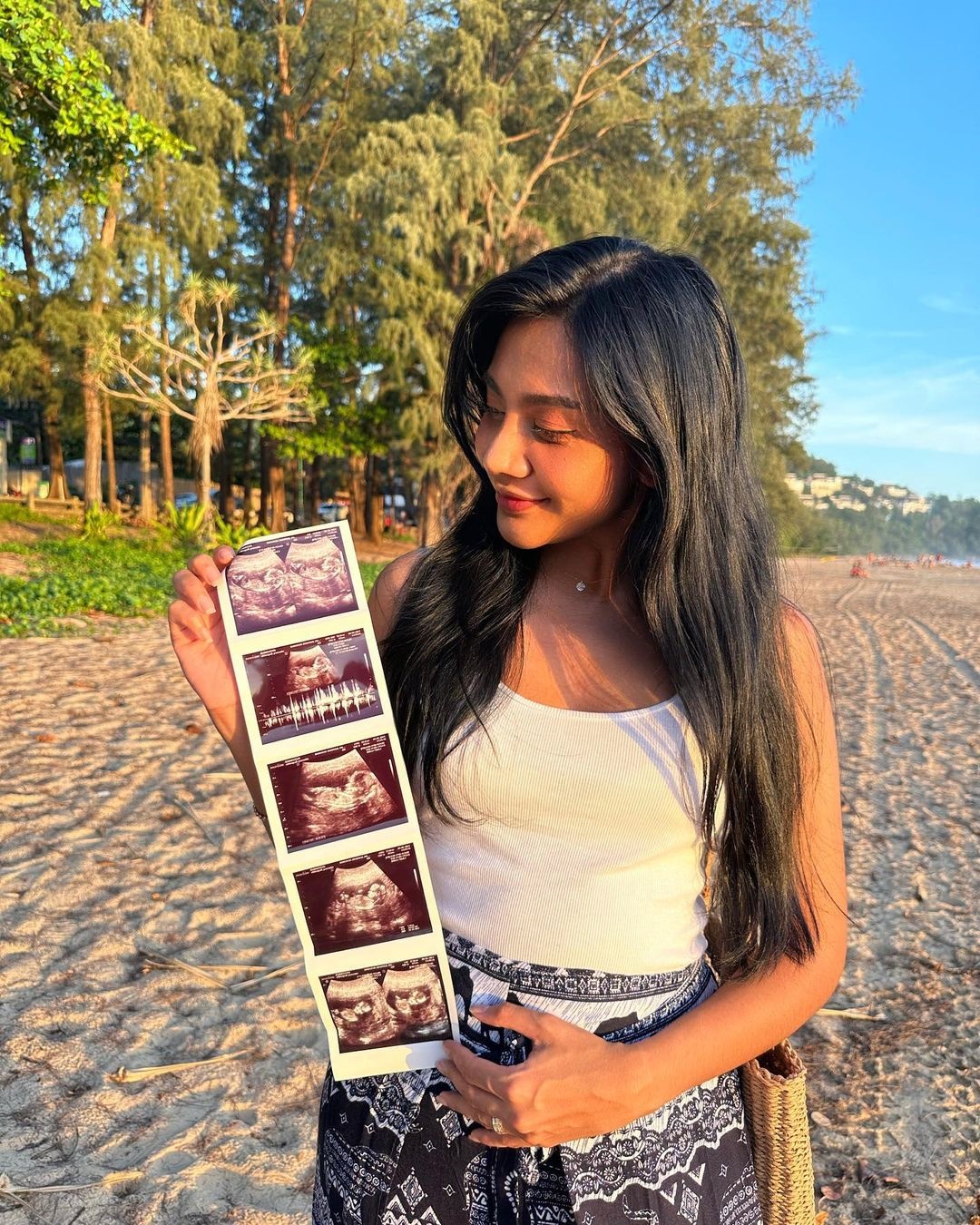 เกศ จิณภัค น้องสาว แก้ม เดอะสตาร์ 