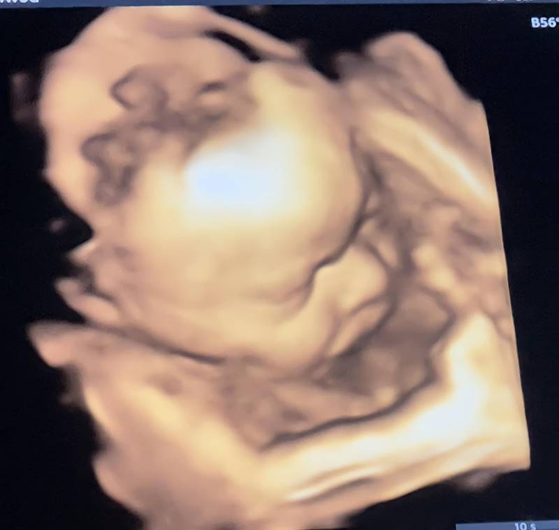 เจนนี่ ยิว  เผยภาพอัลตราซาวด์ลูกสาว