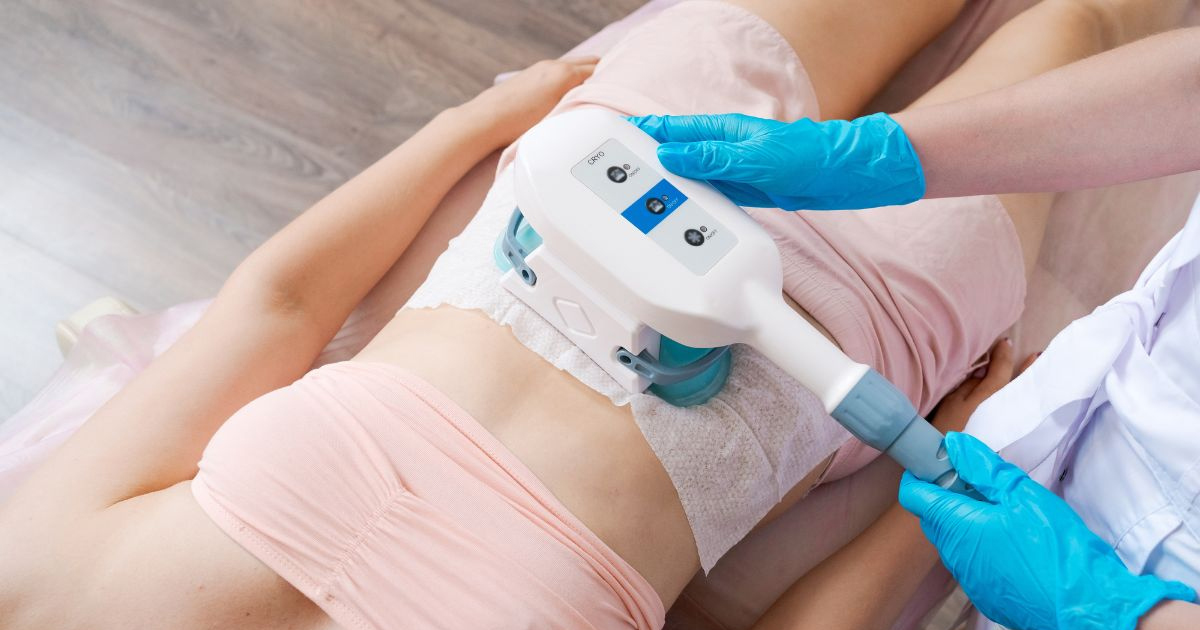 สลายไขมันด้วยความเย็น