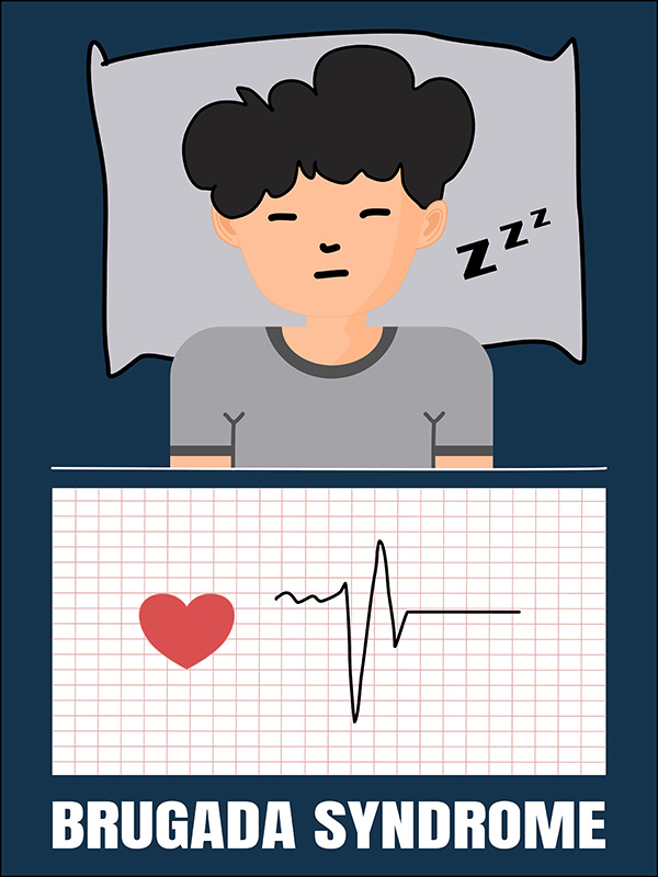 โรคไหลตาย อาการเตือน