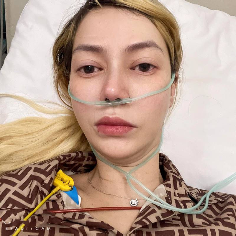 โอเด็ต เล่านาทีเฉียดตาย